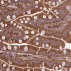 Immunohistochemical staining of human small intestine shows moderate granular cytoplasmic positivity in glandular cells.