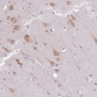 Immunohistochemical staining of human cerebral cortex shows moderate granular cytoplasmic positivity in neurons.
