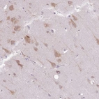 Immunohistochemical staining of human cerebral cortex shows moderate granular cytoplasmic positivity in neurons.