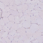 Immunohistochemical staining of human skeletal muscle shows no positivity in myocytes as expected.