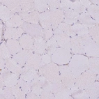 Immunohistochemical staining of human skeletal muscle shows no positivity in myocytes as expected.