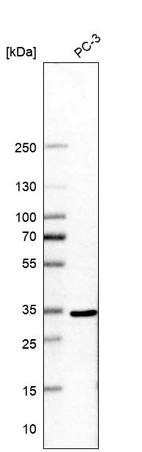 Western blot analysis in human cell line PC-3.