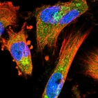 Immunofluorescent staining of human cell line U-251 MG shows localization to the Golgi apparatus.