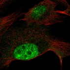 Anti-ZNF606 Antibody