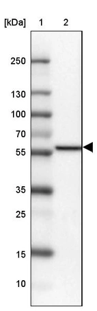Lane 1: Marker [kDa] 250, 130, 100, 70, 55, 35, 25, 15, 10_br/_Lane 2: Human cell line U-87 MG