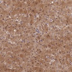 Anti-SLC25A41 Antibody