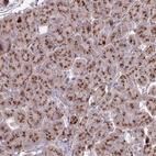 Anti-HS2ST1 Antibody