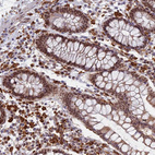 Anti-GPATCH1 Antibody