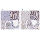 Immunohistochemical staining of human cerebral cortex, colon, kidney and testis using Anti-NOL4L antibody HPA043600 (A) shows similar protein distribution across tissues to independent antibody HPA041768 (B).