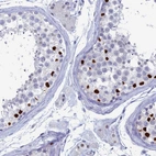 Immunohistochemical staining of human testis shows high expression.