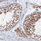 Immunohistochemical staining of human testis shows strong nuclear positivity in cells in seminiferous ducts and moderate cytoplasmic positivity in Leydig cells.