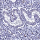 Immunohistochemical staining of human endometrium shows low expression as expected.