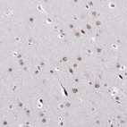 Immunohistochemical staining of human cerebral cortex shows moderate nuclear positivity in neurons.