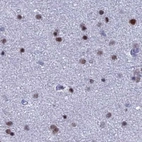 Immunohistochemical staining of human cerebral cortex using Anti-NOL4L antibody HPA043600.
