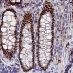 Immunohistochemical staining of human colon using Anti-NOL4L antibody HPA043600.
