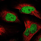 Immunofluorescent staining of human cell line U-2 OS shows localization to nucleoplasm.