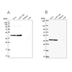Western blot analysis using Anti-CCDC94 antibody HPA043606 (A) shows similar pattern to independent antibody HPA055675 (B).