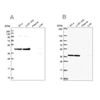 Western blot analysis using Anti-CCDC94 antibody HPA043606 (A) shows similar pattern to independent antibody HPA055675 (B).