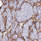 Anti-FGF7 Antibody