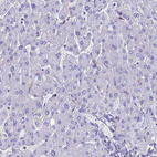 Anti-FGF7 Antibody