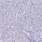 Immunohistochemical staining of human liver shows no positivity in hepatocytes as expected.