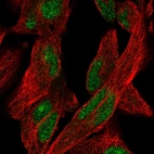 Immunofluorescent staining of human cell line RH-30 shows localization to nucleus & nucleoli.