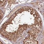 Anti-RGL3 Antibody
