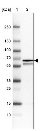 Lane 1: Marker [kDa] 250, 130, 100, 70, 55, 35, 25, 15, 10_br/_Lane 2: Human cell line RT-4