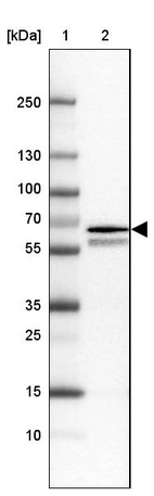 Lane 1: Marker [kDa] 250, 130, 100, 70, 55, 35, 25, 15, 10_br/_Lane 2: Human cell line RT-4