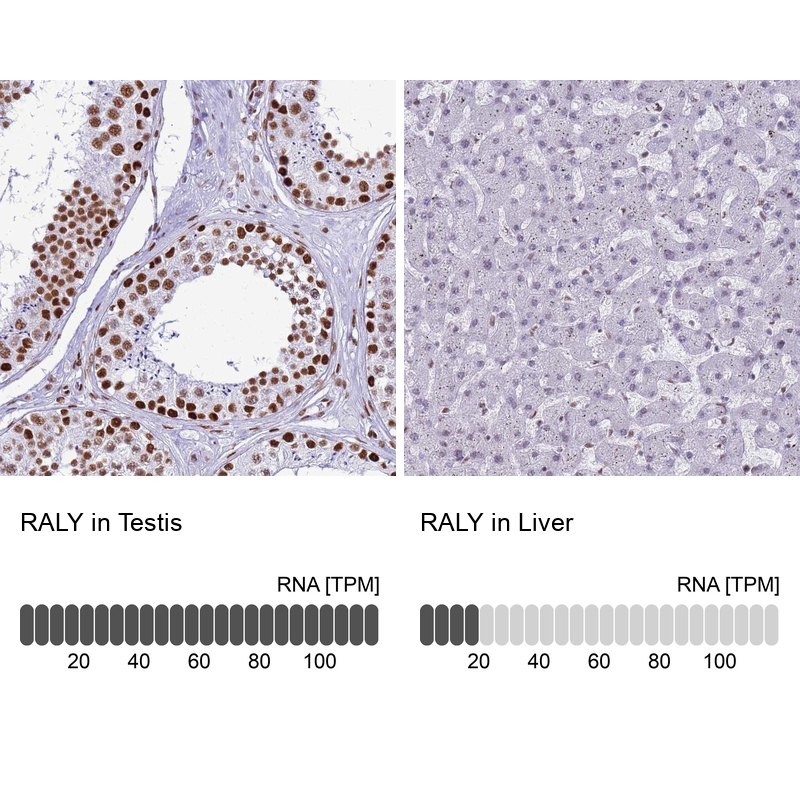 Anti-RALY Antibody