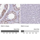 Anti-RALY Antibody