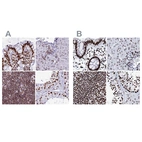 Immunohistochemical staining of human colon, liver, lymph node and testis using Anti-RALY antibody HPA043614 (A) shows similar protein distribution across tissues to independent antibody HPA040971 (B).