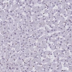 Immunohistochemical staining of human liver shows low expression as expected.
