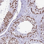 Immunohistochemical staining of human testis shows high expression.
