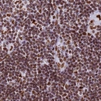 Immunohistochemical staining of human lymph node using Anti-RALY antibody HPA043614.