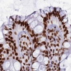 Immunohistochemical staining of human colon using Anti-RALY antibody HPA043614.