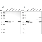 Western blot analysis using Anti-RALY antibody HPA043614 (A) shows similar pattern to independent antibody HPA040971 (B).