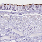 Immunohistochemical staining of human bronchus shows strong positivity in cilia of respiratory epithelial cells.