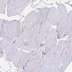 Immunohistochemical staining of human skeletal muscle shows no positivity in myocytes as expected.