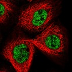Immunofluorescent staining of human cell line A-431 shows localization to nucleoplasm.