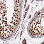 Anti-RALGAPA2 Antibody