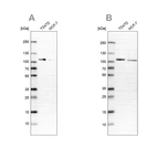 Anti-OSBP Antibody