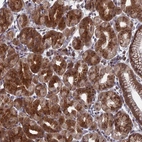 Anti-FAM160B1 Antibody