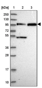 Lane 1: Marker [kDa] 250, 130, 95, 72, 55, 36, 28, 17, 10_br/_Lane 2: Human cell line RT-4_br/_Lane 3: Human cell line U-251MG sp