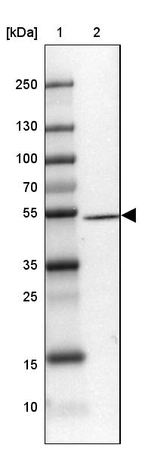 Lane 1: Marker [kDa] 250, 130, 100, 70, 55, 35, 25, 15, 10_br/_Lane 2: Human cell line MOLT-4