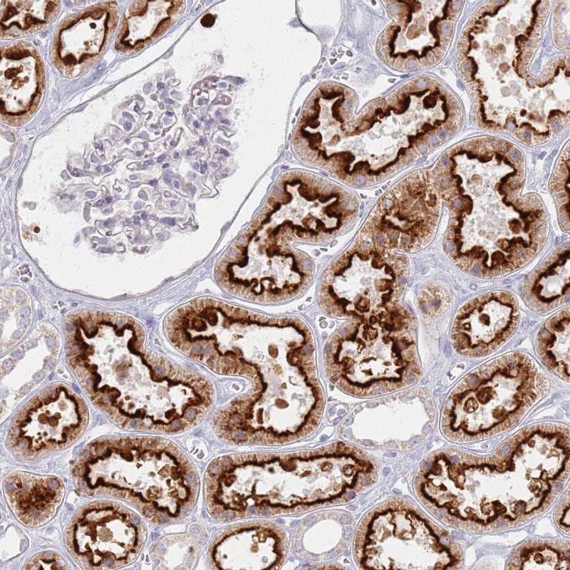 Anti-PKD2L2 Antibody