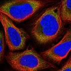 Immunofluorescent staining of human cell line U-2 OS shows localization to cytosol.