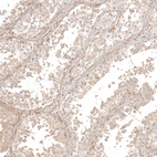 Immunohistochemical staining of human testis shows moderate membranous positivity in Leydig cells.