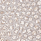 Immunohistochemical staining of human rectum shows moderate membranous and cytoplasmic positivity in glandular cells.