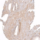 Immunohistochemical staining of human prostate shows moderate membranous positivity in smooth muscle cells.